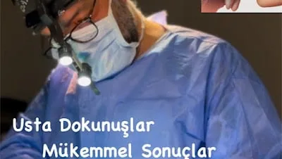 Bursa Burun Estetiği