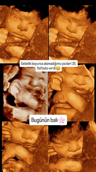 Chir. dr. Gülçin Üstün Serpim