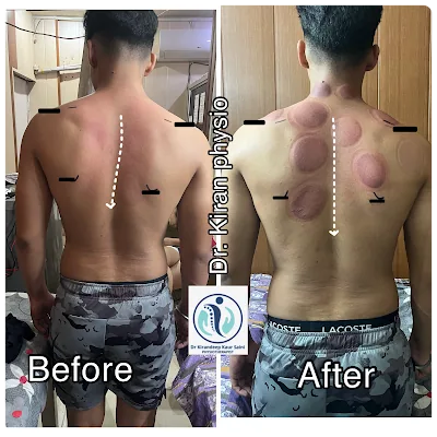 Dr. Kiran Physio &