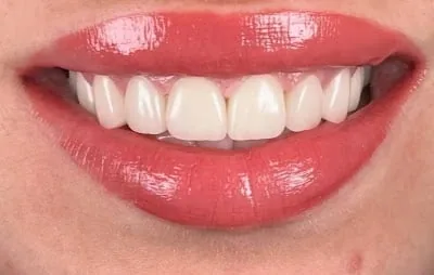 Doç. Zekeriya Taşdemir Gülüş Tasarımı Smile Design