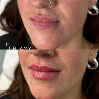Dr Amy Aesthetics