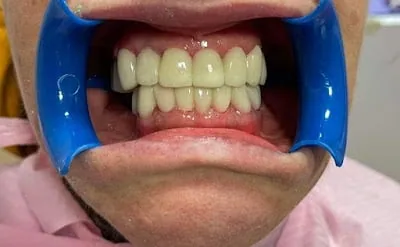 DBDent Dental Clinic