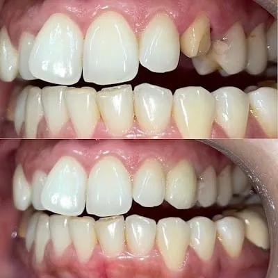 Bristles Dental Studios