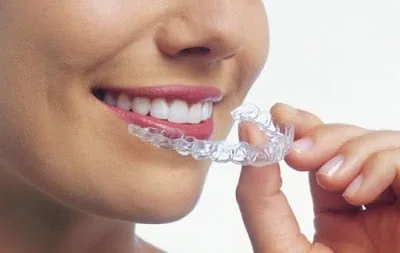 Invisalign Şeffaf Plak Tedavisi