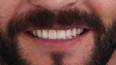 DentPlus Batman