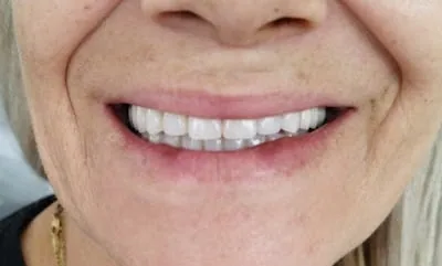 Kaval Ağız ve Diş Sağlığı Polikliniği