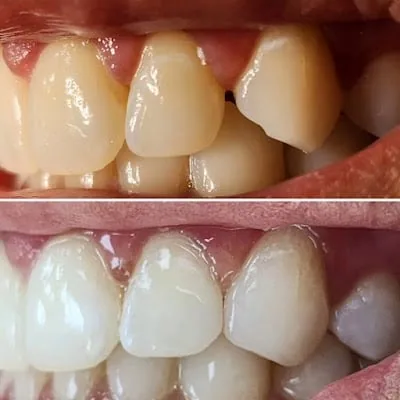 طبيب الأسنان وائل الحسني الجزائري.عيادة أسنان ..DENTIST: Dr.Wael Al hasani Al jazaeri .Dental clinic