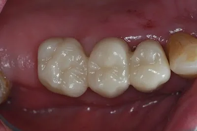 Punta Cana Oral Health