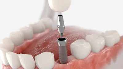Oralc Oralchirurgie & Implantologie Zahnärzte Friedrichshain