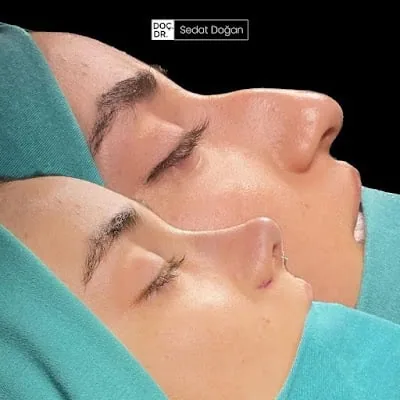 UHD dr. Sedat Doğan