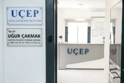 UÇEP