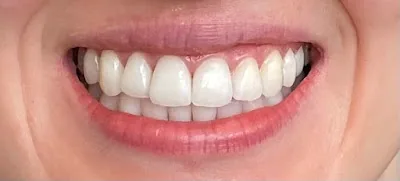 Somerhill Smiles Family Dental & Implants
