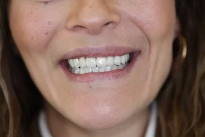SUBA DENTAL