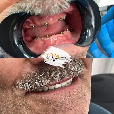 AS Dental Group Ağız ve Diş Sağ. Pol.