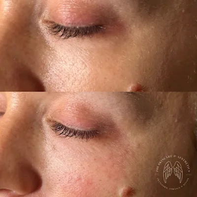 Zoi Skincare and Aesthetics
