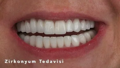 Büşra Tekin